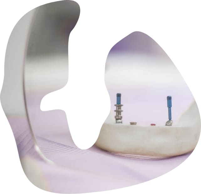 Centro Odontoiatrico Salernitano | Implantologia